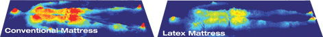 xsensor pressure mapping